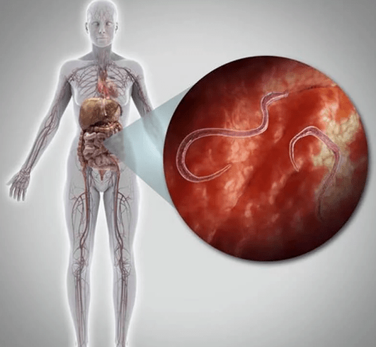 Pasożyty w ludzkim ciele
