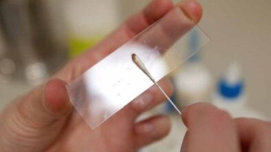 Analiza Calais w celu zidentyfikowania pasożytów