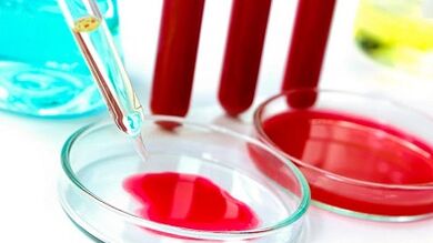 Badanie krwi dla pasożytów