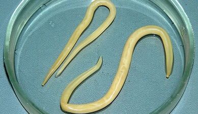 Jak poprawnie wykonać testy na Ascariasis