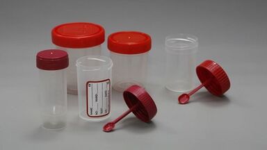 Jak przygotować się do testu pasożytów