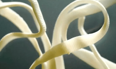 Jak usunąć pasożyty z ludzkiego ciała